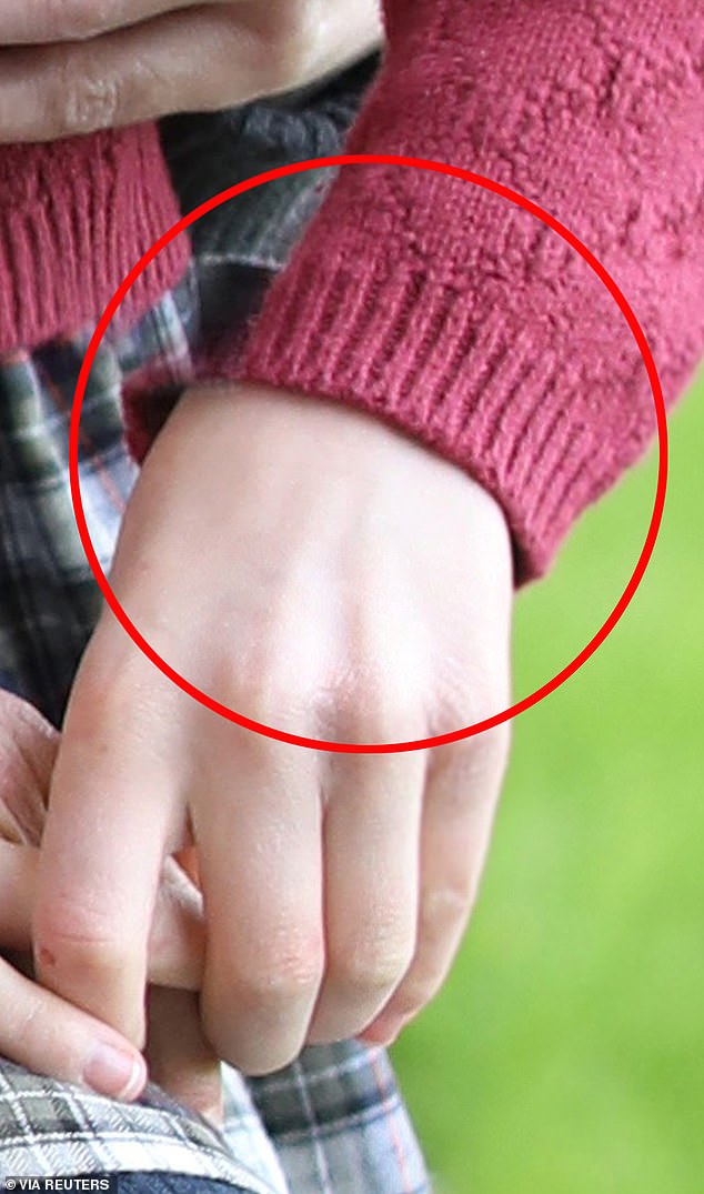 It looks like Charlotte's hand was copied over from another image as there is an empty space where her sleeve should be