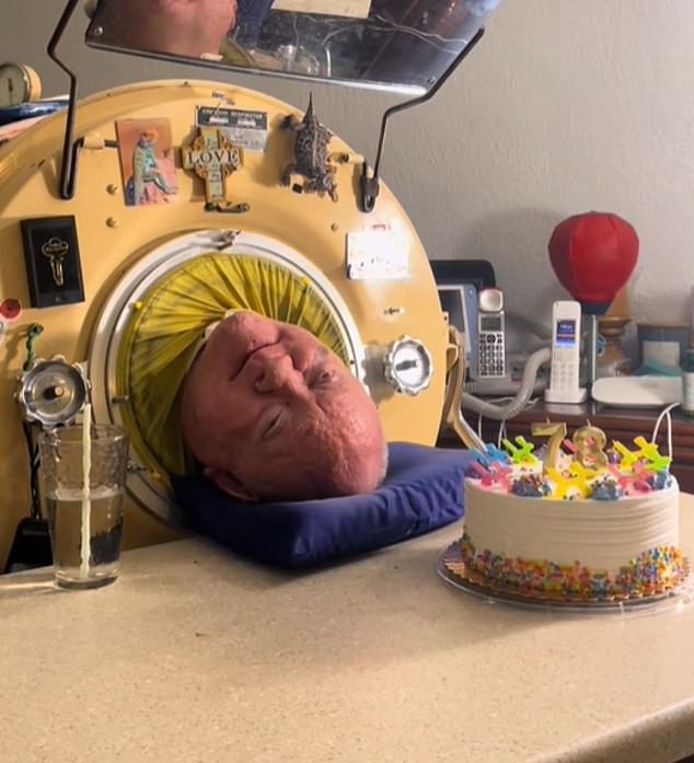 Paul celebrates his 78th birthday on 30 January 2024 after more than 70 years in the iron lung