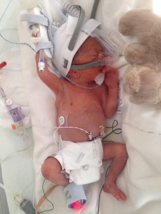Arthur was born prematurely at 26 weeks and was diagnosed with a brain tumor before he turned three.