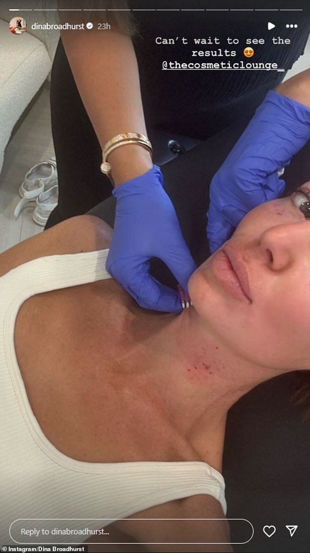 The 'nude artist', who looks a decade younger than her 46 years, shared a selfie to her Instagram Stories which showed her getting cosmetic treatment done on her neck