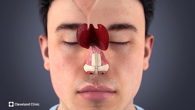 They rebuilt part of his nose using cartilage from his ear and bone from his ribs