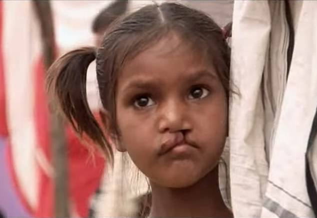 Smile Pinki told the story of the cruel abuse and teasing the little girl suffered for having a cleft lip, before receiving surgery that would change her life.