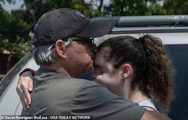 Dewey kisses his father Robert Dewey, 47, before his nose reconstruction surgery