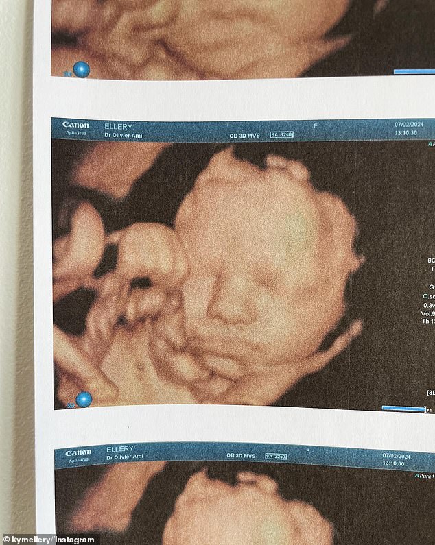 The 39-year-old revealed her growing baby bump in an Instagram post on Thursday, when she shared a series of images, including her latest ultrasound (pictured).