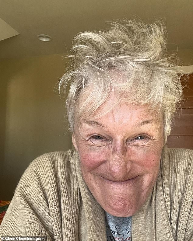 The Fatal Attraction star, who marked her special day on Tuesday, March 19, shared a few selfies on Instagram in which she showed off her dramatic facial bruises after patching up her injury.