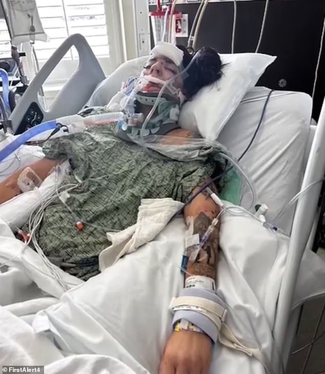 The mother of two suffered severe head trauma, including internal bleeding. Although doctors say she was showing signs of improvement on Monday and was able to come off the ventilator.