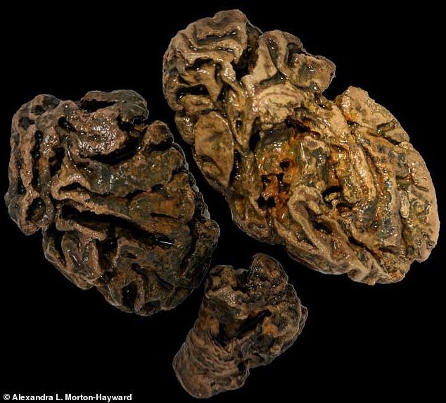 Brain fragments from a person buried in a Victorian cemetery around 200 years ago in Bristol, UK.  No other soft tissue survived among the bones, which were excavated from the heavily waterlogged grave.