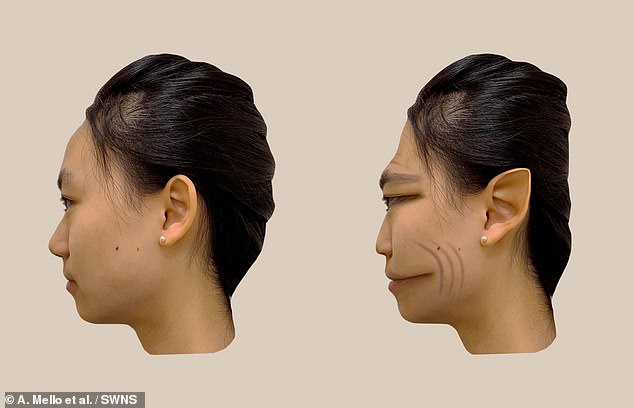 The researchers obtained real-time feedback from the patient on the difference between the face on the screen and the real face in front of them, by modifying the photograph using computer software to match the distortions perceived by the patient.
