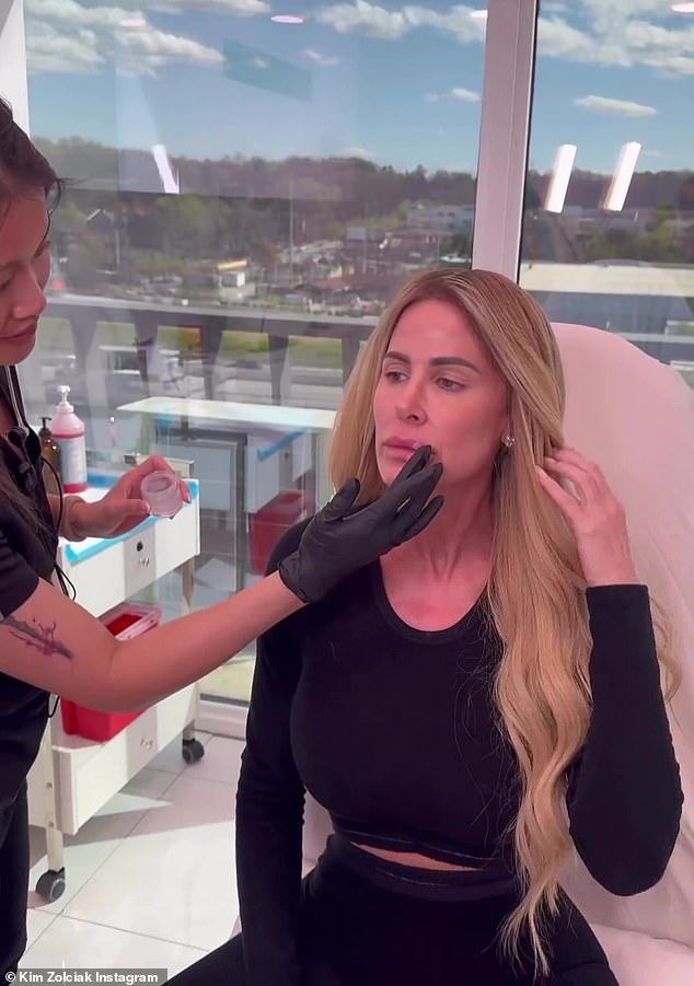 1711189410 706 Real Housewives of Atlanta alum Kim Zolciak gets fillers and