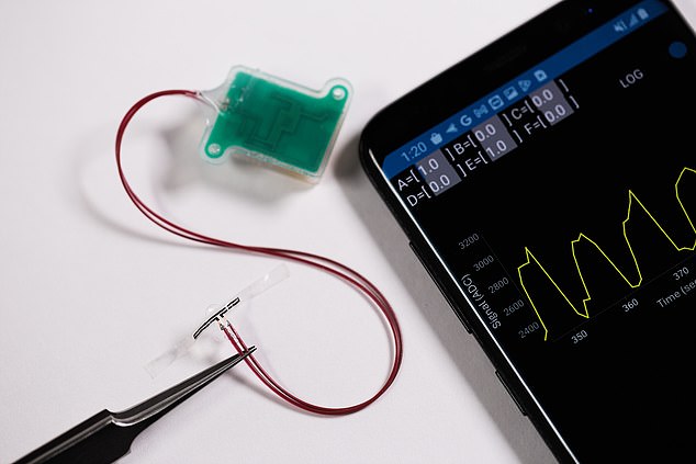 The device wirelessly and continuously transmits data to a smartphone app, so users (and their doctors) can monitor bladder filling and function in real time.
