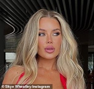 Skye Wheatley has revealed all the cosmetic surgery she has had over the years to transform her into the blonde bombshell she is today.  She is pictured on the left on Big Brother in 2014 and on the right this year.