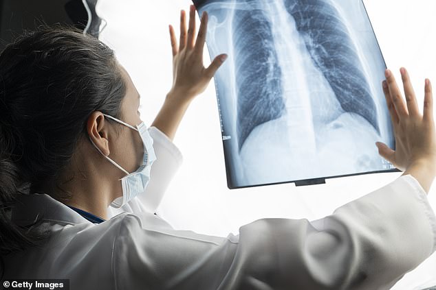 New recommendations say people should start getting screened for lung cancer when they reach age 50