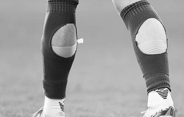Poking holes in your socks relaxes the muscle and helps prevent cramps caused by increased pressure.