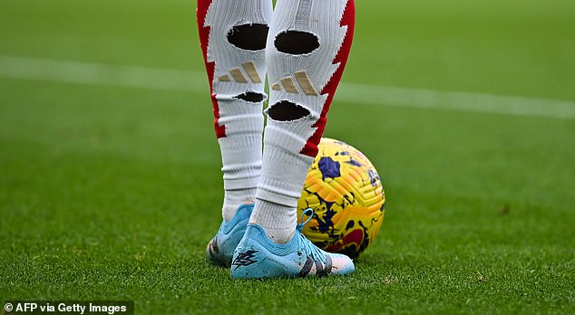 Bukayo Saka shows the hole cut in his socks, which reduces pressure on the calf muscle.