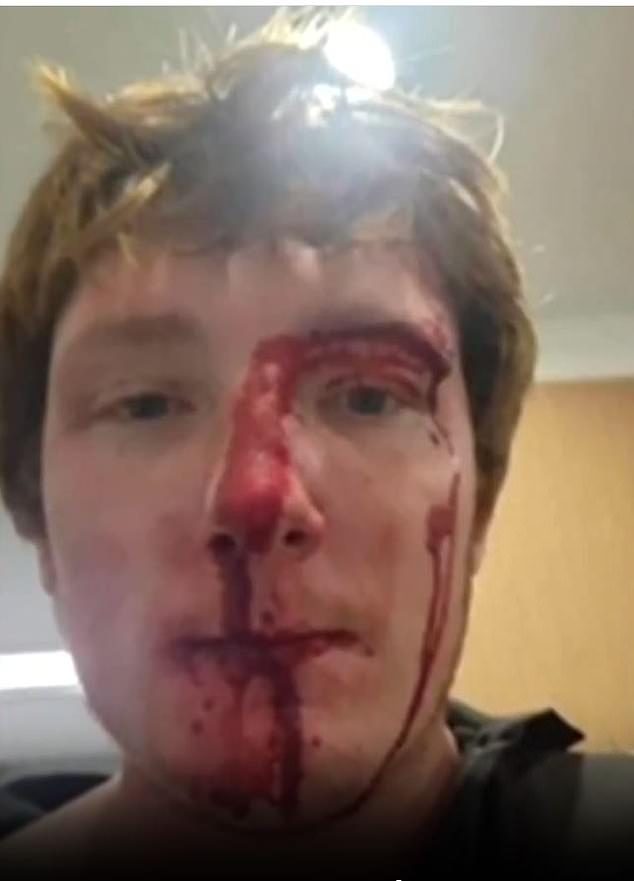 Khoby Dawson, 22, was left with a bloody nose and a cut above his eye from the attack (pictured) at McDonald's in Raymond Terrace.