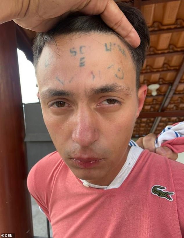 Da Silva had the tattoo partially removed but some letters are still clearly visible on his forehead