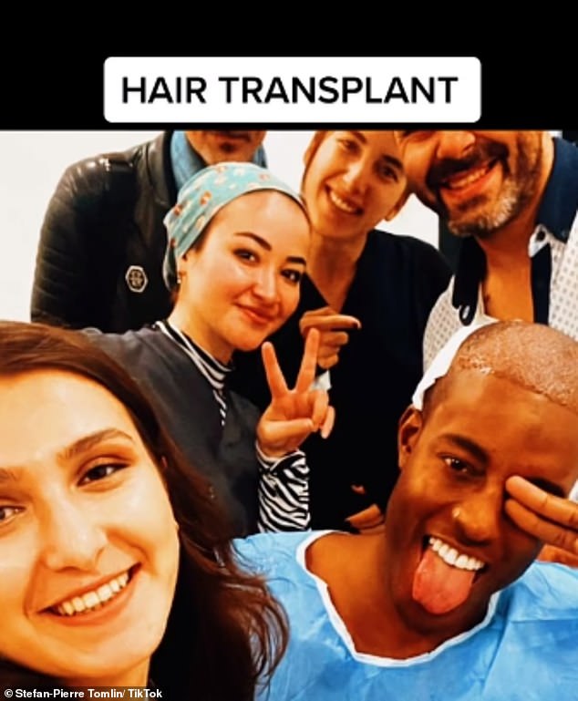 However, behind the scenes, he struggled with his confidence and attempted to mask the receding hairline that had plagued him since he was 22, before undergoing a hair transplant.