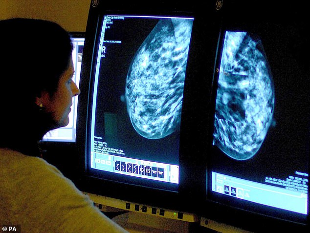 Officials have written to each affected woman, apologizing for the mistake and offering them an urgent scan.  The error meant that women who received above-the-waist radiation therapy for Hodgkin lymphoma between 1962 and 2003 were not contacted to attend annual breast cancer screenings.
