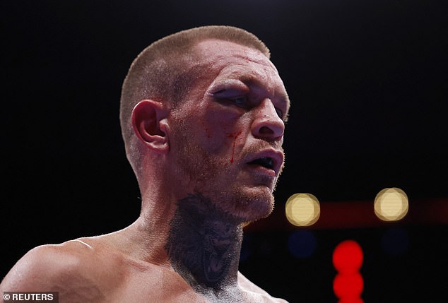 British boxer on Joshua vs Ngannou undercard suffers GRUESOME eye