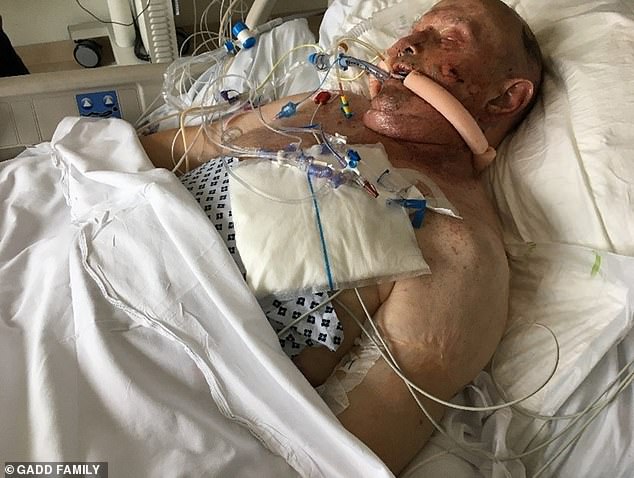 In the UK, it is now recommended that doctors test for genetic predisposition to chemotherapy complications, after cases such as Keith Gadd's (pictured) came to light.  The 73-year-old farmer had started taking capecitabine in 2018 and after five days of using the drug his health deteriorated.