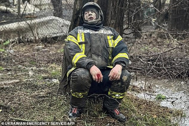 A firefighter, covered in dust and bleeding, sits against a tree after the brutal attack