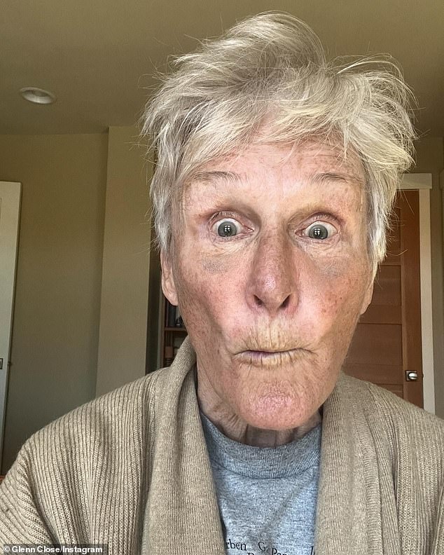 Glenn Close revealed she broke her nose days before turning 77