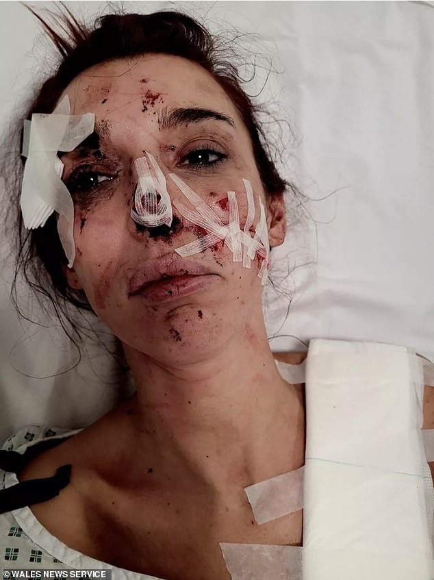 Natalie Arthurs was brutally attacked by Emily Williams, 25, in the toilets of the Peppermint Bar on Swansea's Wind Street in an unprovoked assault.