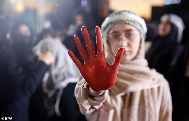 A protester shows a hand covered in fake blood as pro-Palestinian supporters gather for an anti-Israel rally to show their solidarity with the people of Gaza in Palestine Square in Tehran, Iran
