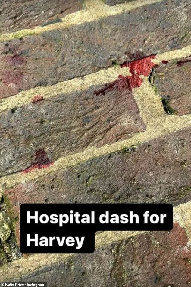 The former Glamor model took to Instagram today to share a photo of blood-spattered bricks and revealed that Harvey, 21, had to go to A&E.