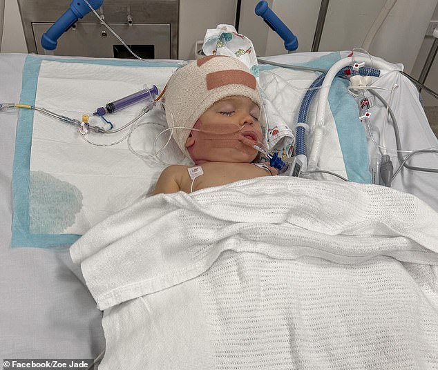 Darwin boy Kealii Jevdenijevic (pictured) underwent surgery on January 23 to remove a tumor surrounding his brain stem.