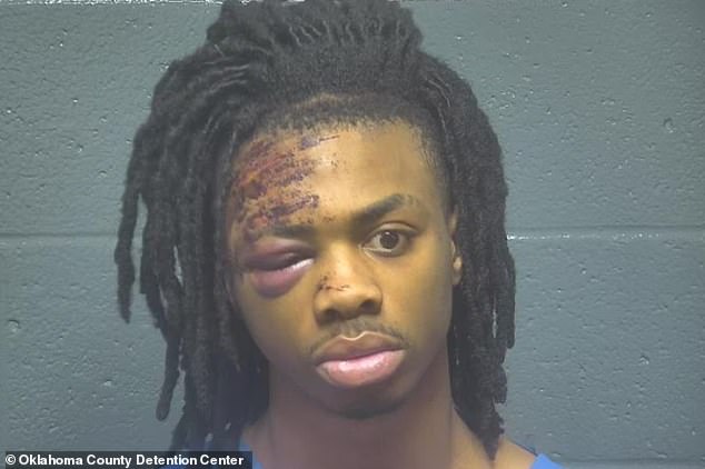 Taber 'Turbo' Carter, 21, appears bruised and scraped following a police chase that ended in a car crash after he was accused of pointing a gun at a woman he was supposed to buy a pair of shoes from. designer.