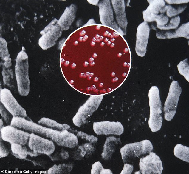 A New Mexico man has become the first to die of the plague in the US this year after contracting Yesinia Pestis bacteria (pictured, in red file)