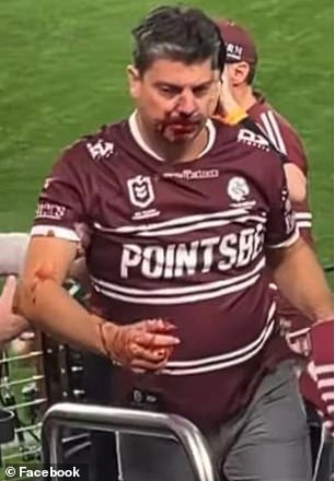 A Manly fan was left bloodied while watching his team play in Las Vegas on Sunday.