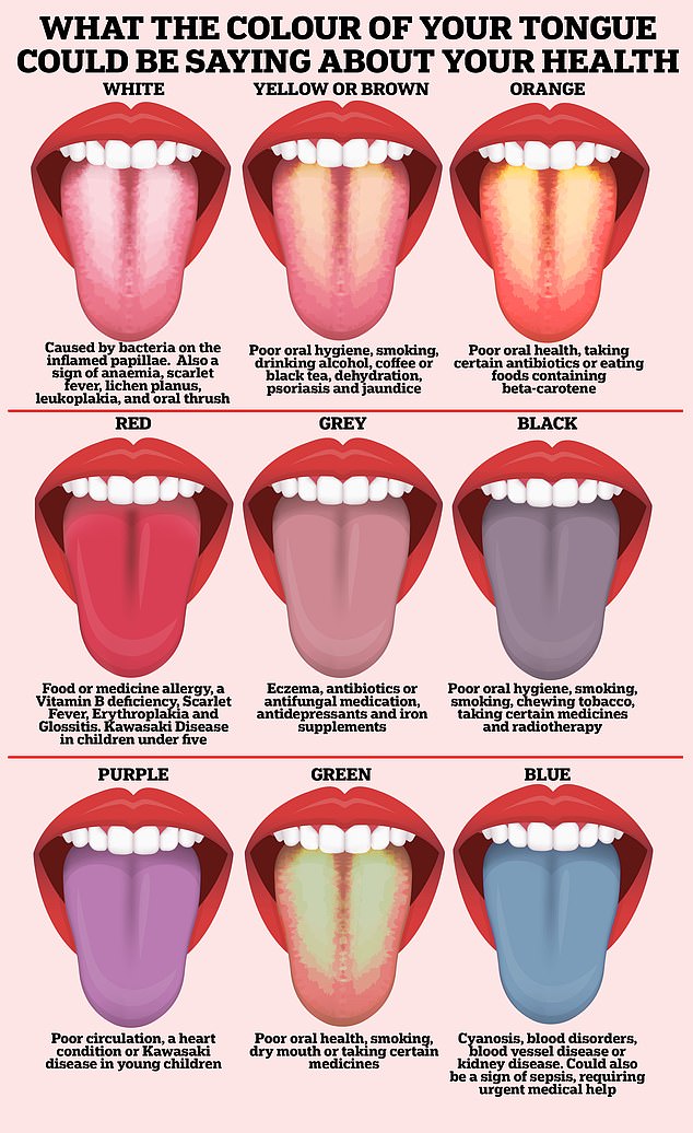 A healthy tongue should be pink, with small bumps ¿ or papillae - across the surface.  However, a number of other colors can be signs that a person is ill
