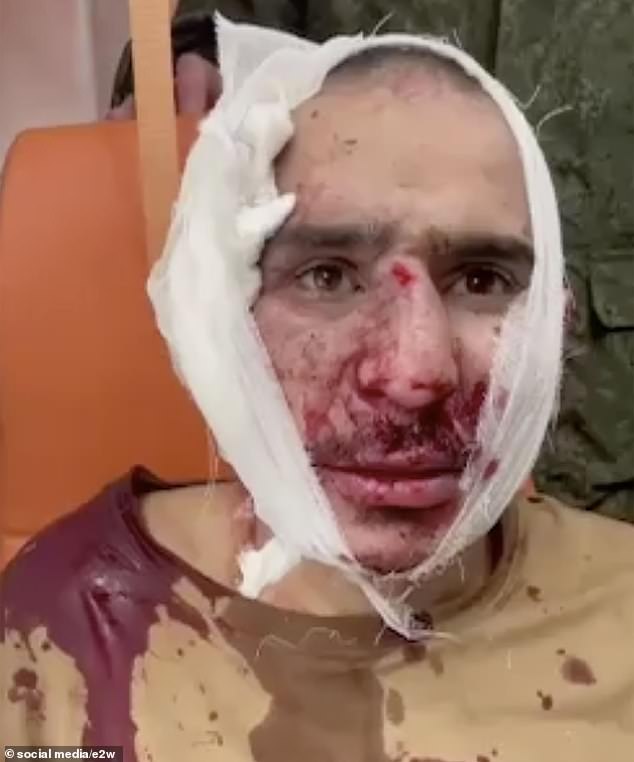 One of the suspected terrorists in the mass shooting at the Crocus City concert hall appeared on Russian television with a bandage over his ear.