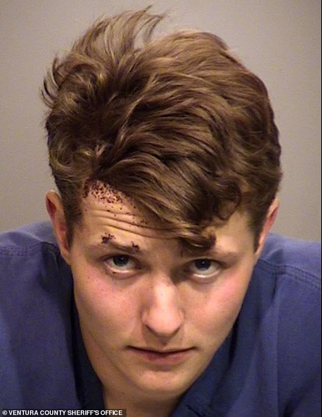 Scott Goldberg's mugshot shows the 21-year-old had visible injuries when he was arrested on November 19, 2024.