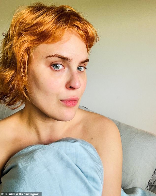 Tallulah Willis, 30, revealed that she recently had her facial fillers dissolved.