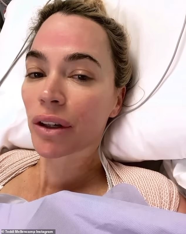 Teddi Mellencamp's doctors have found another 'abnormal spot' three months after she underwent surgery in her battle against skin cancer