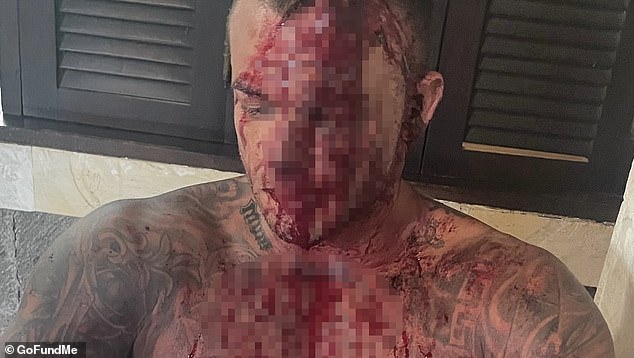 Two Australians have been hospitalized after being stabbed repeatedly by a group of men in Bali, the girlfriend of one of the victims has said.