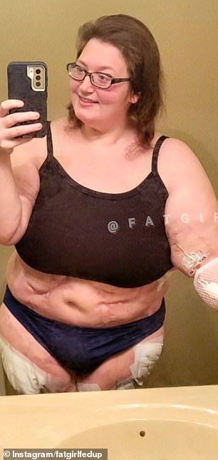 Weight loss influencer Lexi Reed (seen before) teased her figure after losing 100 pounds.
