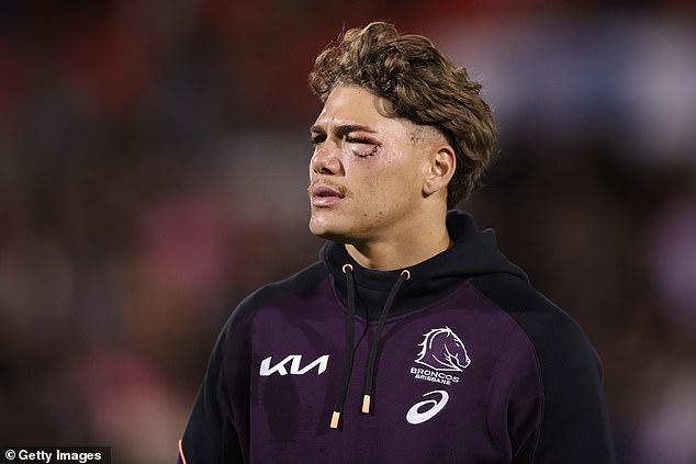 Brisbane's injury crisis has deepened with star fullback Reece Walsh expected to be sidelined after scans showed a facial fracture following his sickening knock against Penrith.