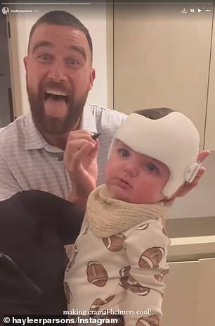 Kelce signed Chrome's cranial helmet, which adjusts to correct the shape of a baby's skull.