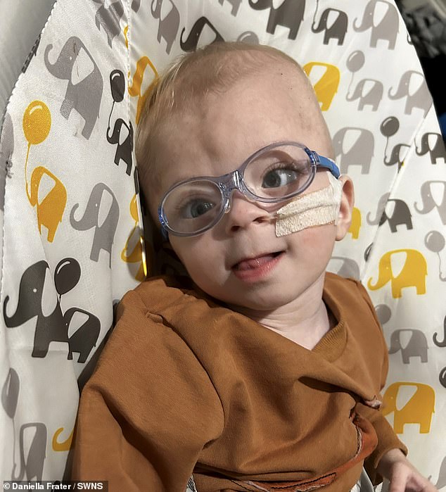 1712059487 110 Miracle baby born without part of his brain has survived