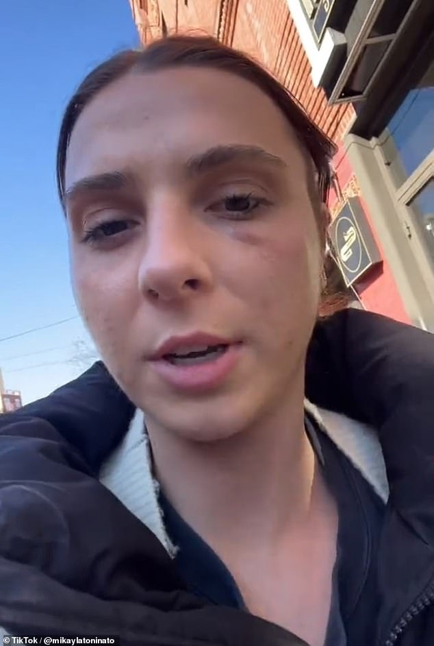 TikTok user Mikayla Toninato went viral after revealing that a man came up and 'hit me in the face'
