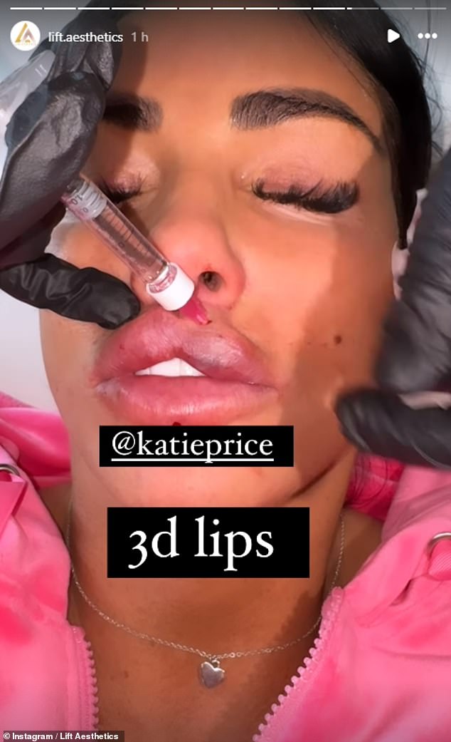 Last month, Katie revealed she had undergone her third round of lip fillers in a matter of weeks, after a visit to Lift Aesthetics.