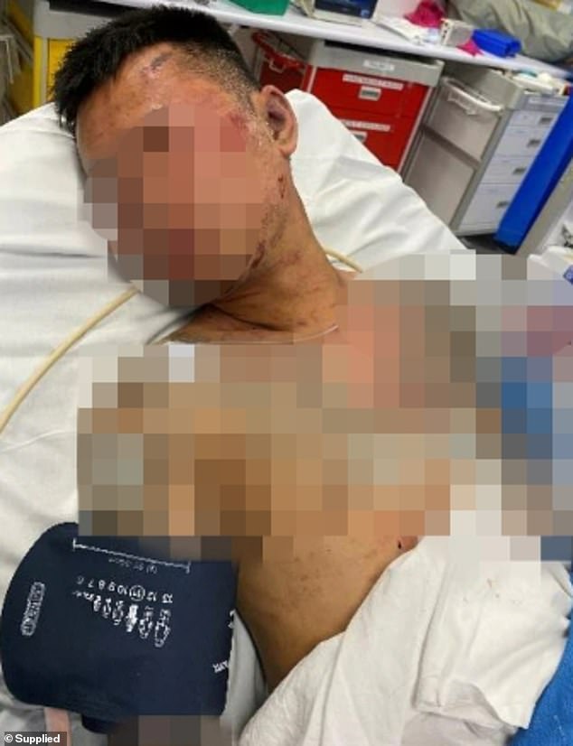 The male victims allegedly had their fingers and toes cut off and one of the men had his head stamped on during the ordeal in February last year.