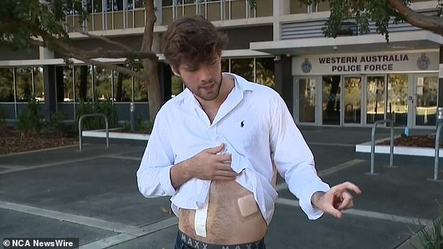 Will was taken to hospital for emergency surgery after he was stabbed to ensure his organs had not been punctured.  Image: 9NEWS
