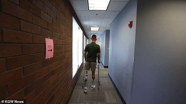 1712389966 259 Double amputee learns to walk again after revolutionary surgery