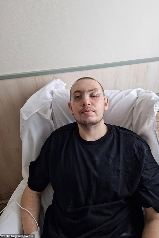 Mr. Ziv is recovering in the hospital. Once he got home. Mr. Ziv became aware of his scars. He said: 'I didn't want anyone to look at me. It was horrible'