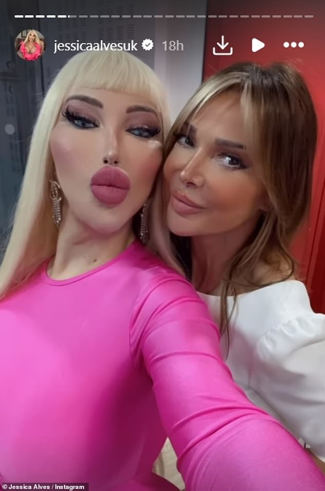 Jessica took to Instagram while posing for Lizzie Cundy before the show.